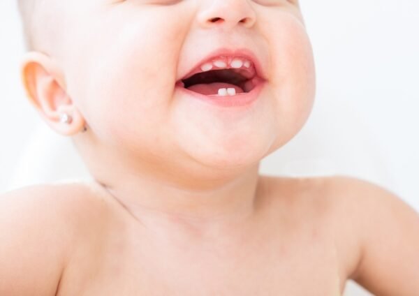 Bebekler Ne Zaman Diş Hekimini Ziyaret Etmeli?